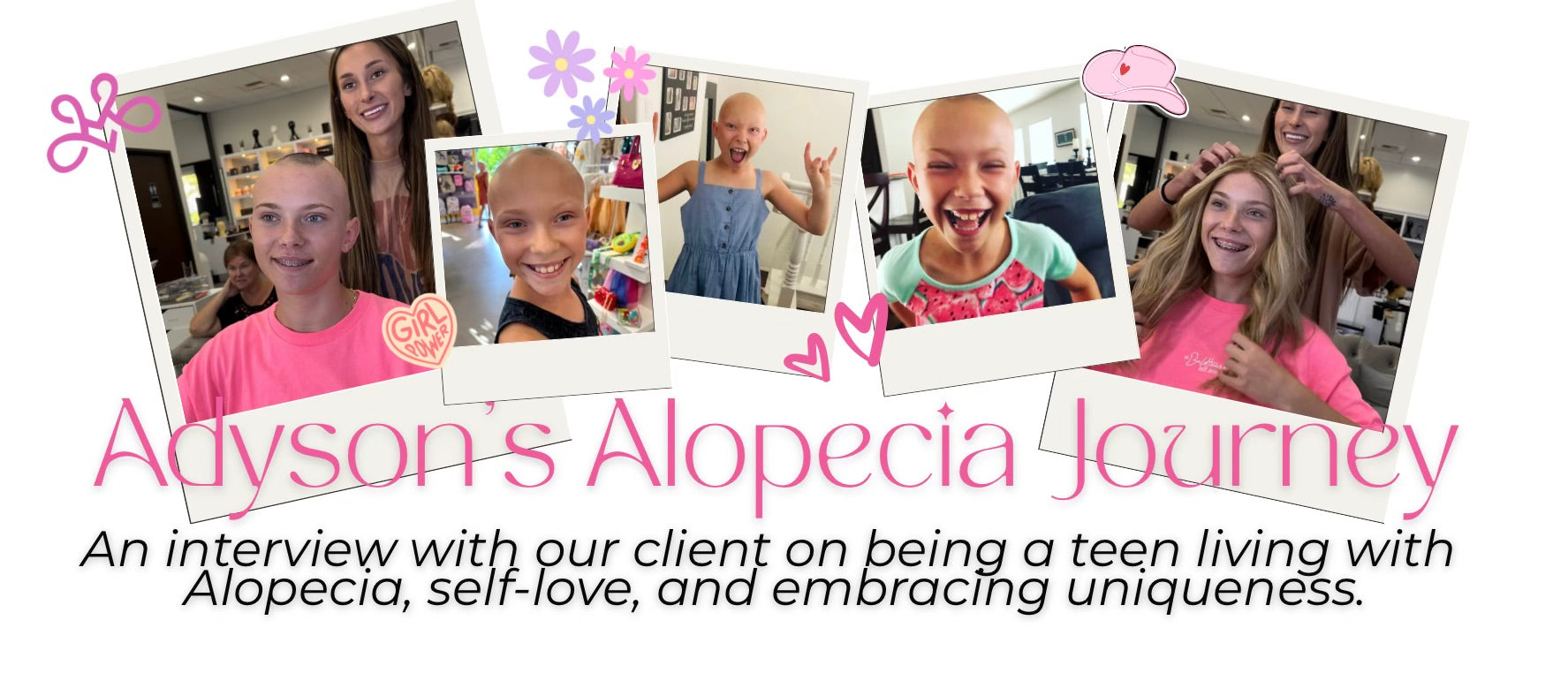 Adyson's Alopecia Journey - Embracing Uniqueness, Self Love, and Confidence