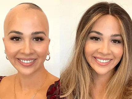 Medical Insurance Wigs